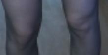 331x171